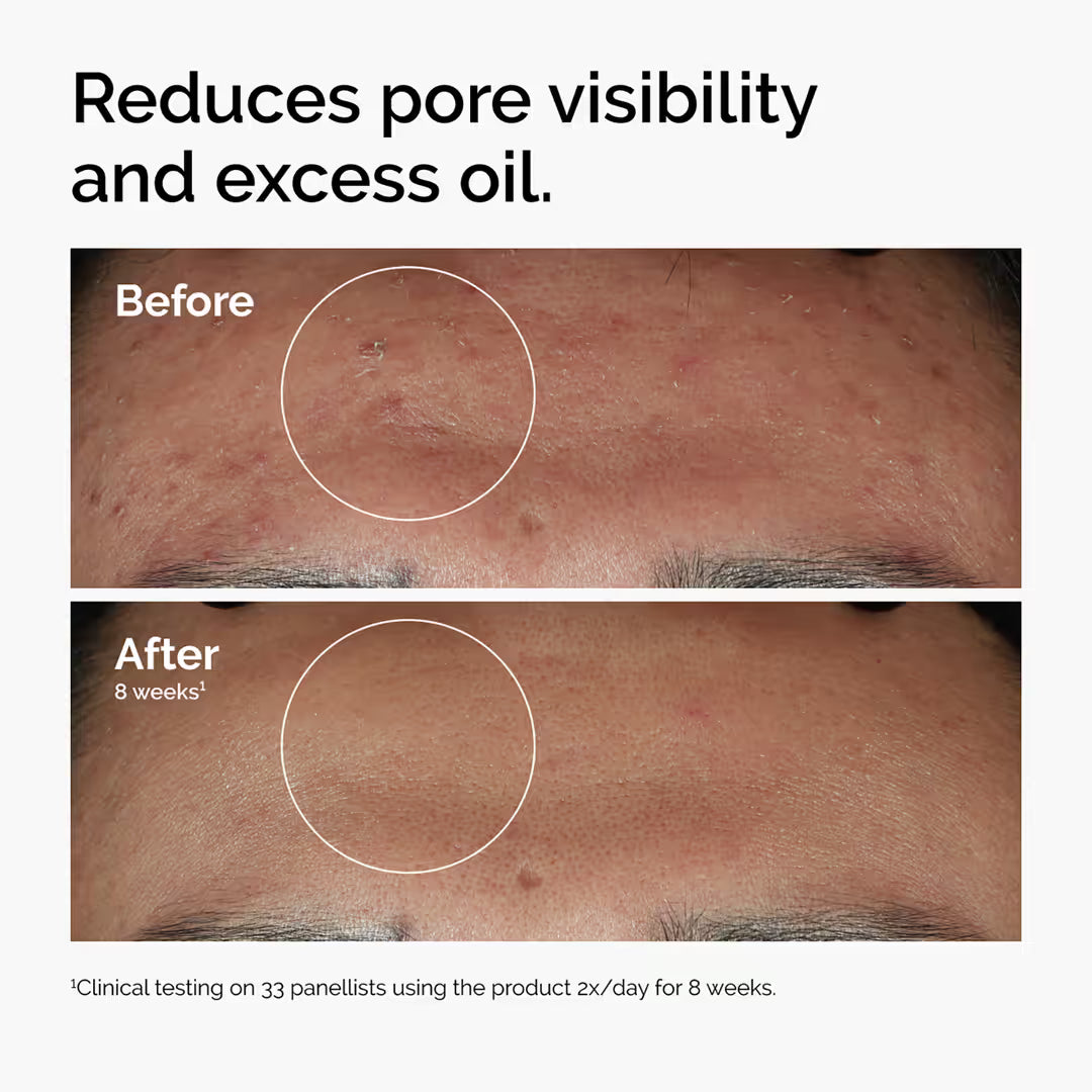 The Ordinary The Glow Collection - Radiant Skin Duo (Glycolic Acid & Hyaluronic Acid)