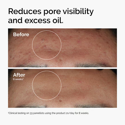 The Ordinary The Glow Collection - Radiant Skin Duo (Glycolic Acid & Hyaluronic Acid)